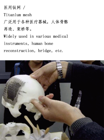 精密蝕刻